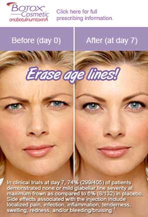 Ft Lauderdale Botox